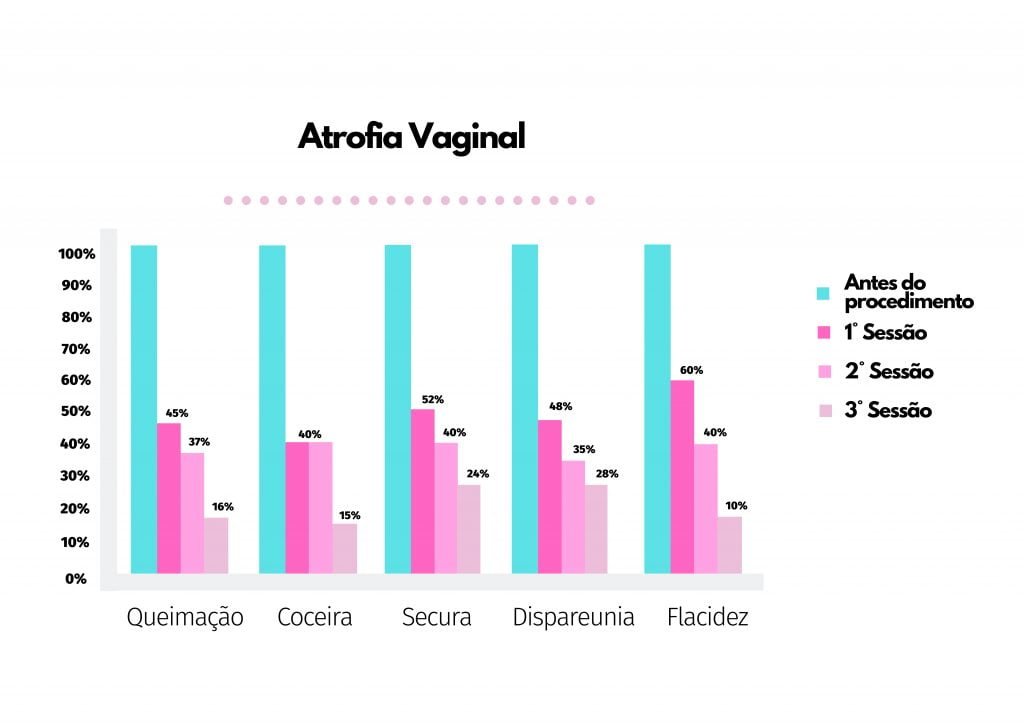 Laser em ginecologia