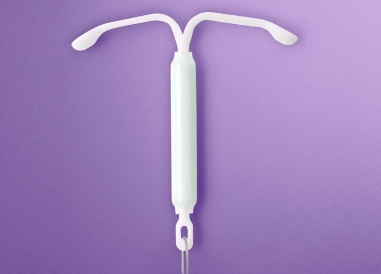 Diu Hormonal Kyleena