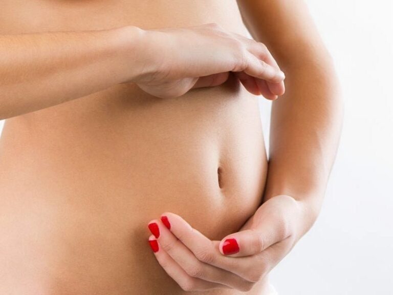 Endometriose Intestinal