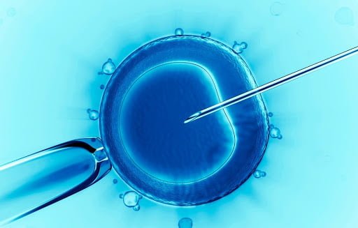 FIV e endometriose no ovário