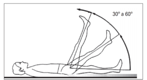 Endometriose no Ciático: exame físico com manobra de lasegue