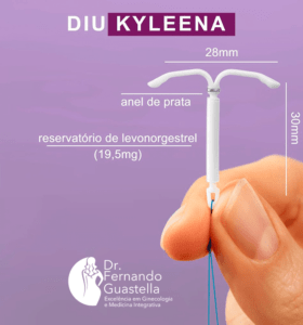 Diu kyleena