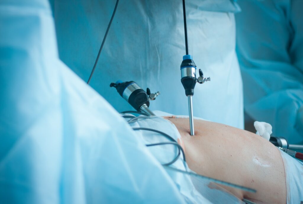 Ginecologista especialista em Histeroscopia cirurgica