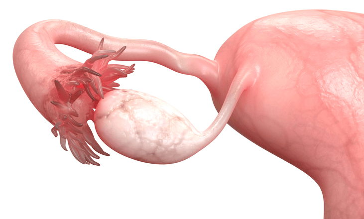 histerossonossalpingografia