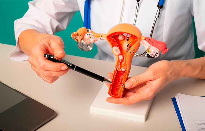 Alcoolização de endometrioma