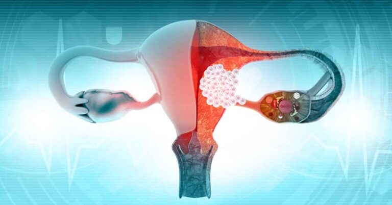 Curso de HYCOSY com mentoria de 3 meses