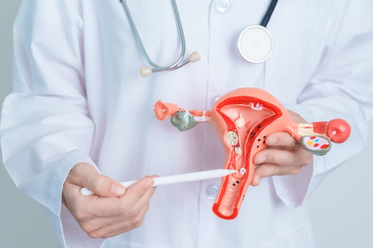 Preparação para a Miomectomia O Que Você Precisa Saber Antes da Cirurgia